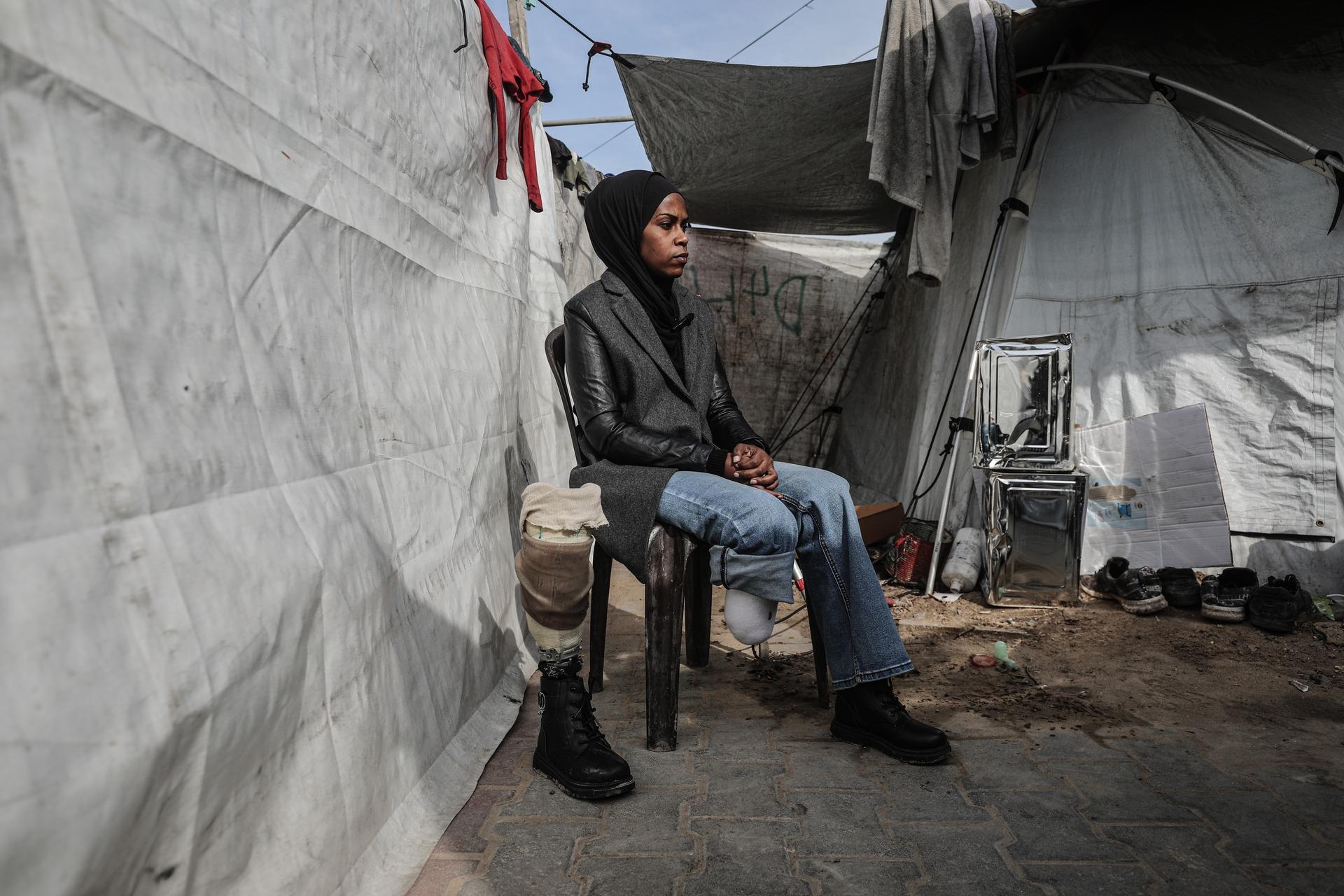 Palestinian schoolteacher Isra Betikh sits outside of her displacement tent in the Nuseirat refugee camp in the central Gaza Strip. She is pictured alongside her prosthetic leg, which he relies on after an Israeli airstrike which killed two of her siblings and forced her leg amputation.